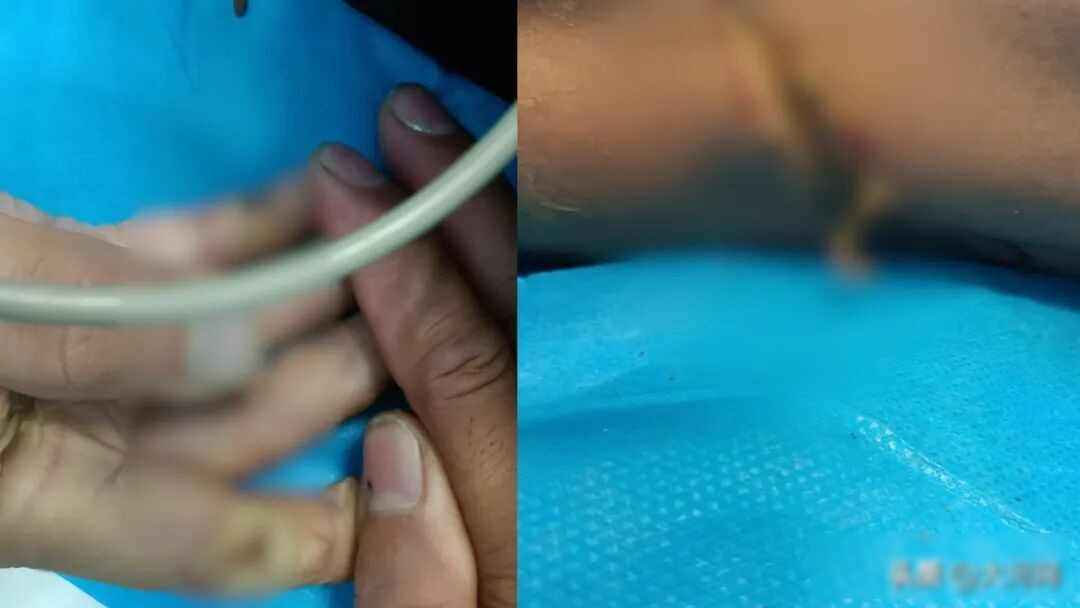 地埋电力管安全警示：兄弟触电悲剧揭露隐藏杀机